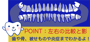 歯科レントゲン